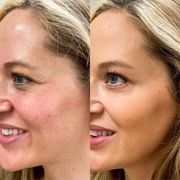 Rachel, 35